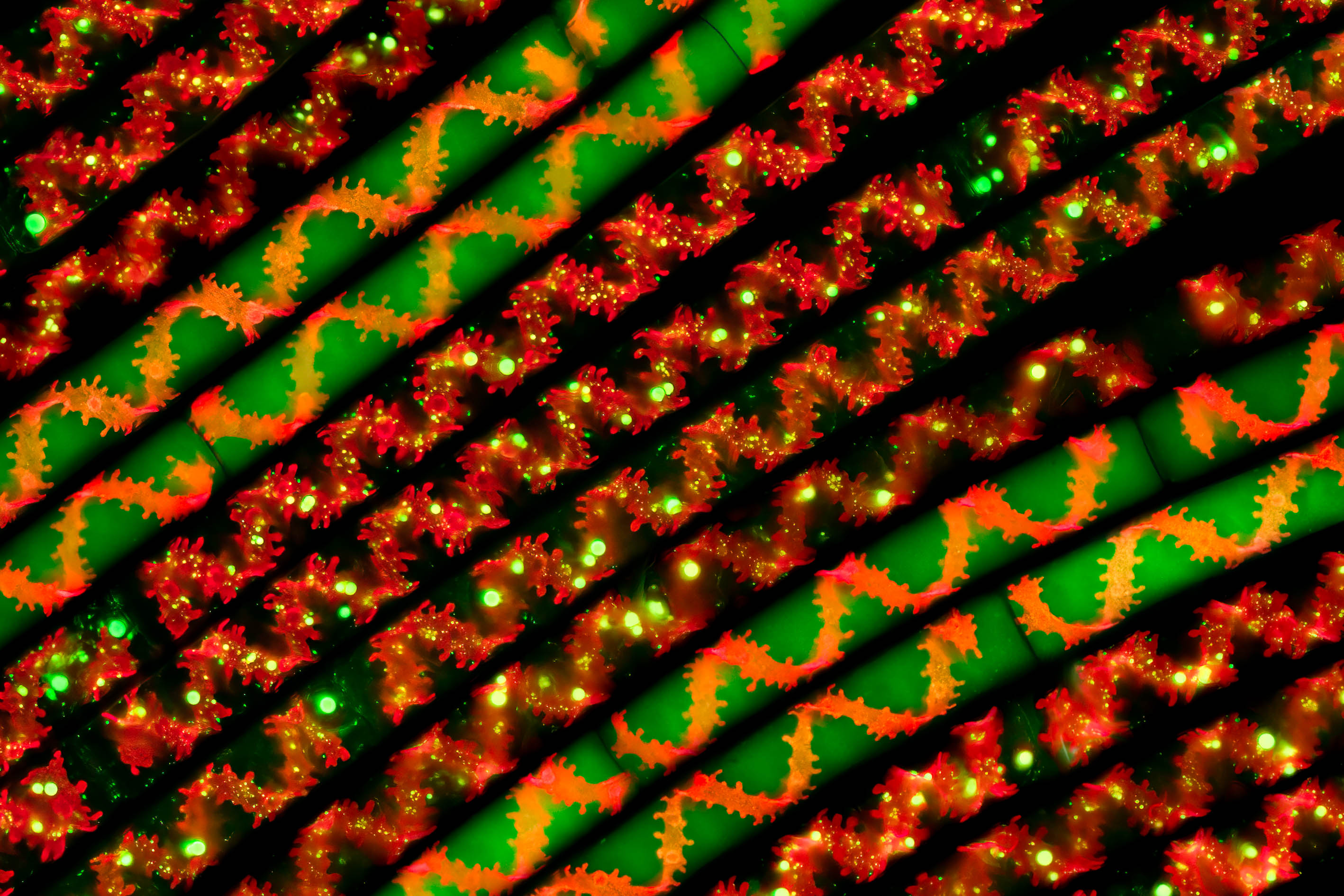 © Hakan Kvarnstrom-Spiral Beauty-CUPOTY03-Micro-1st.jpg